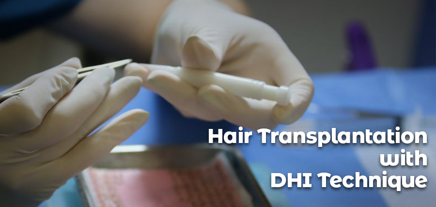DHI Hair Transplant Method and Choi Pen: All You Need to Know - Natural  Hair Turkey