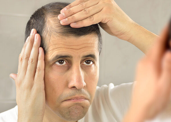Natural Hair Turkey Europe S Leading Hospital In Aesthetic