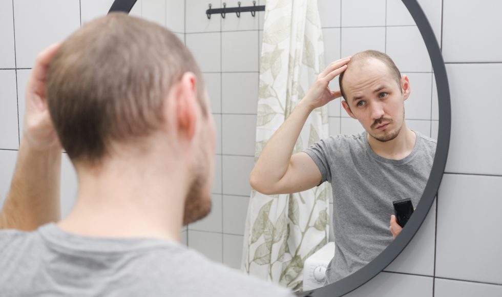 Hair loss can be dealt with thank to hair transplantation