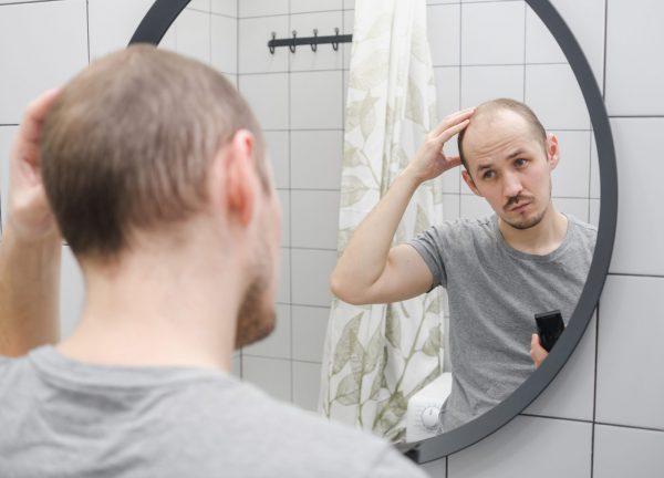 Hair loss can be dealt with thank to hair transplantation