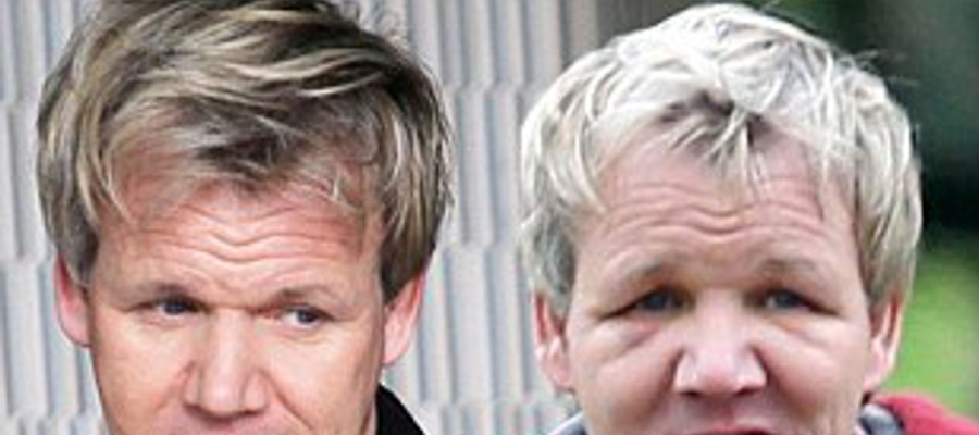 Gordon Ramsay hair transplant before after